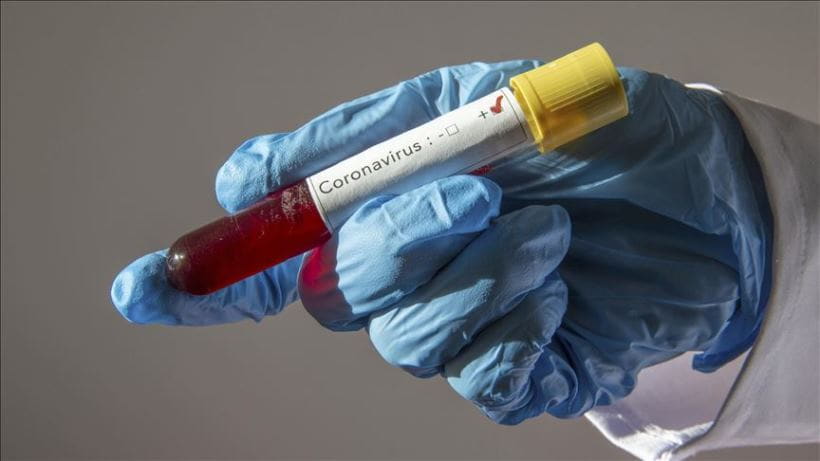 Coronavirus: 32 nuevos casos en las últimas 24 horas