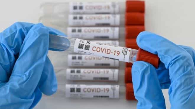 Detectaron en el país dos variantes del COVID-19 provenientes de Brasil
