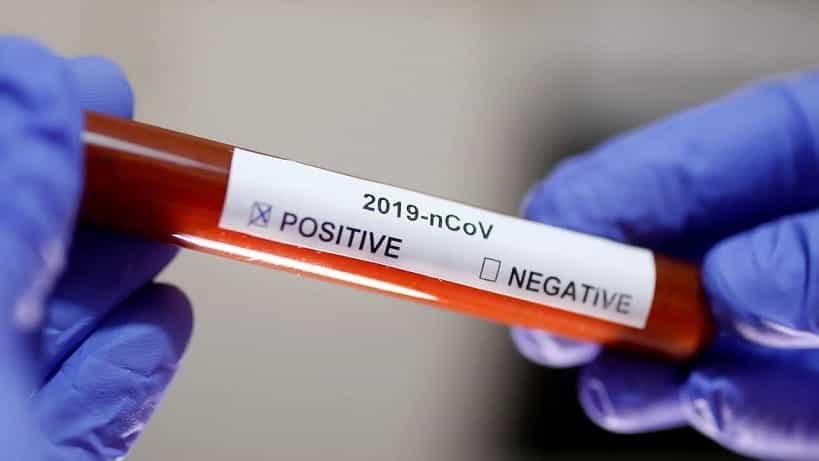 Coronavirus: 32 nuevos positivos