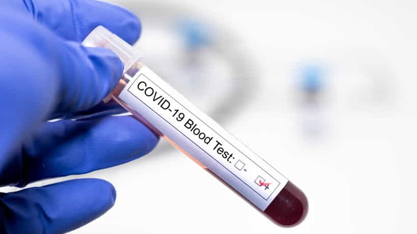 Se detectaron tres casos de coronavirus