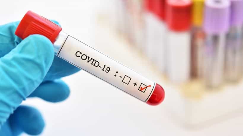 Murió un hombre de 57 años con coronavirus