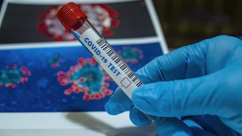 Falleció un hombre de 65 años con coronavirus